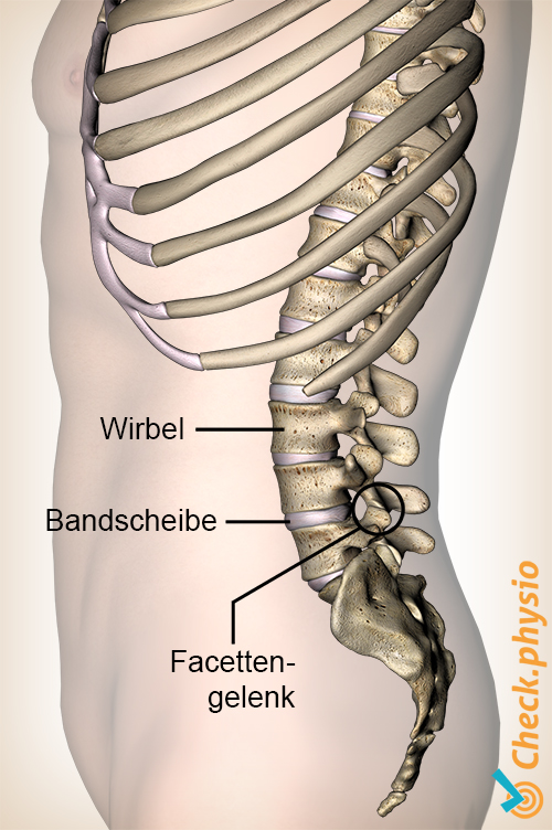 Rücken Bandscheibe Fugenwirbel Lumbales Facettensyndrom