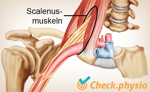 Schulter Arm Hand TOS Thoracic Outlet Syndrom Scalenusdreieck