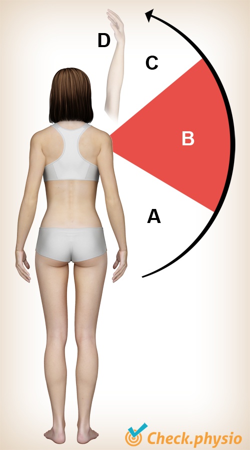 Schulterimpingement Painful Arc