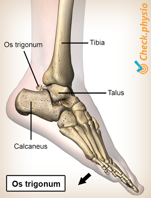 Sprunggelenk hinteres Impingement Os trigonum
