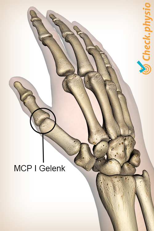 Hand MCP 1 Daumen